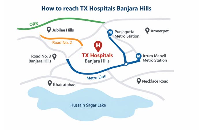 How to reach TX Hospitals Banjara Hills