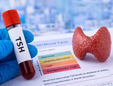 TSH levels blood test and thyroid health concept