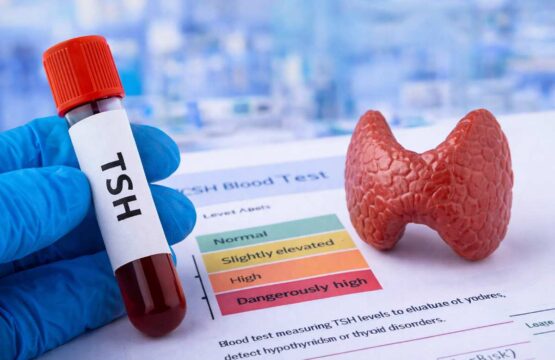 TSH levels blood test and thyroid health concept