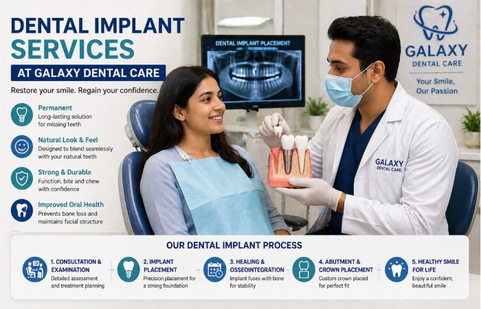 Dental Implant Services at Galaxy Dental Care